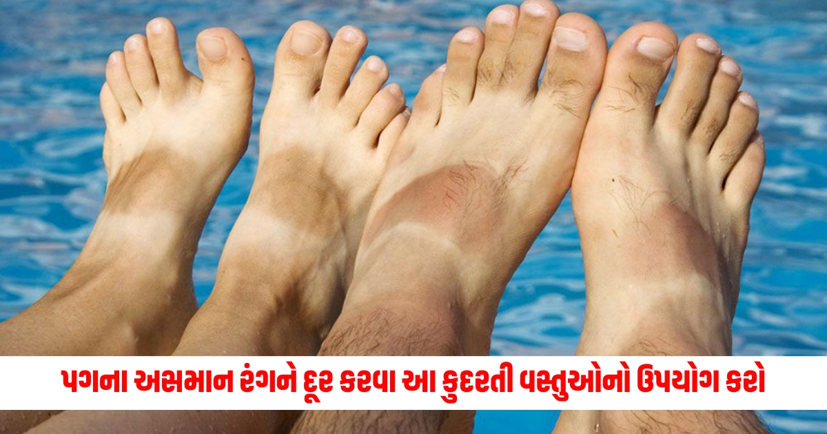 effective home remedies to remove tan from feet