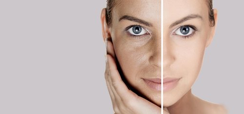 Is your face starting to darken What can cause it and how can it be prevented 1