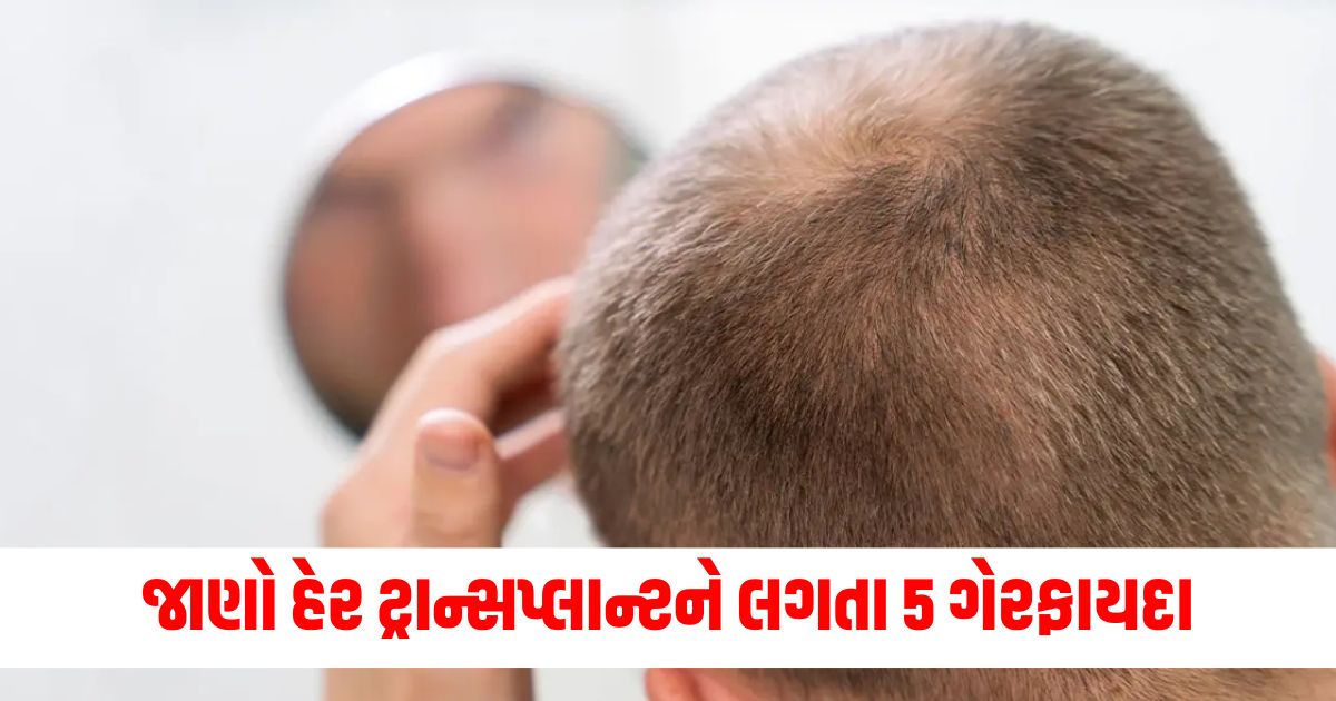 5 side effects of hair transplantation