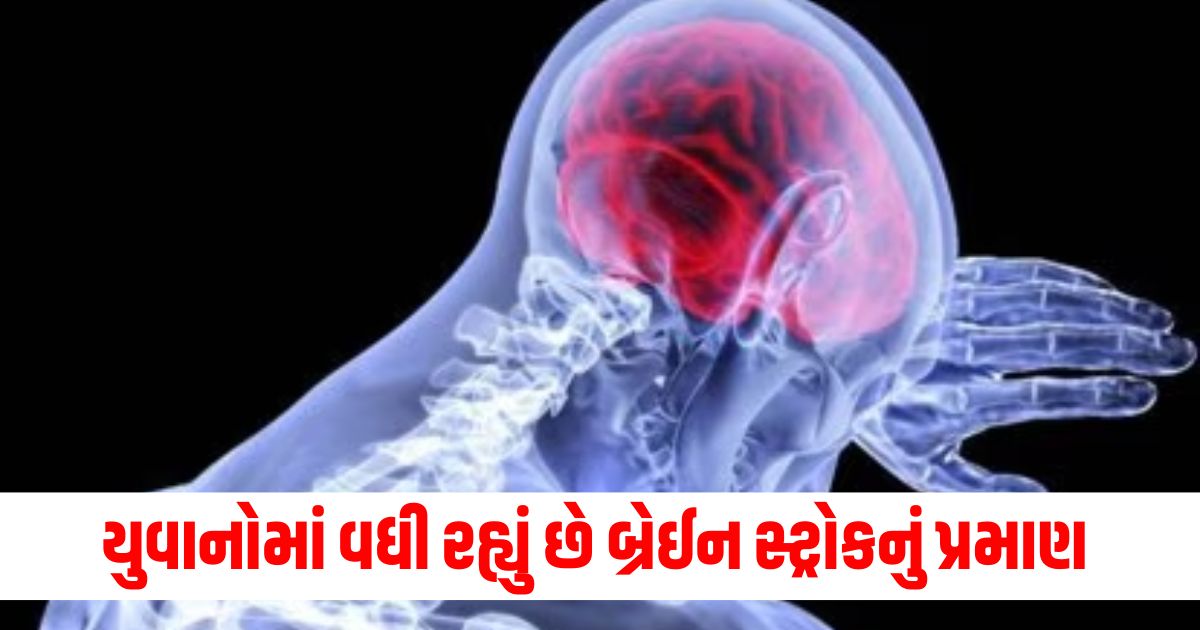 brain stroke is increasing rapidly among youth 15 of patients are up to 40 years of agewerwr