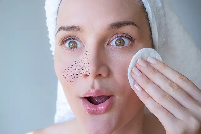 fashion beauty these remedies will make black heads disappear in a jiffy there will be no pain at all2