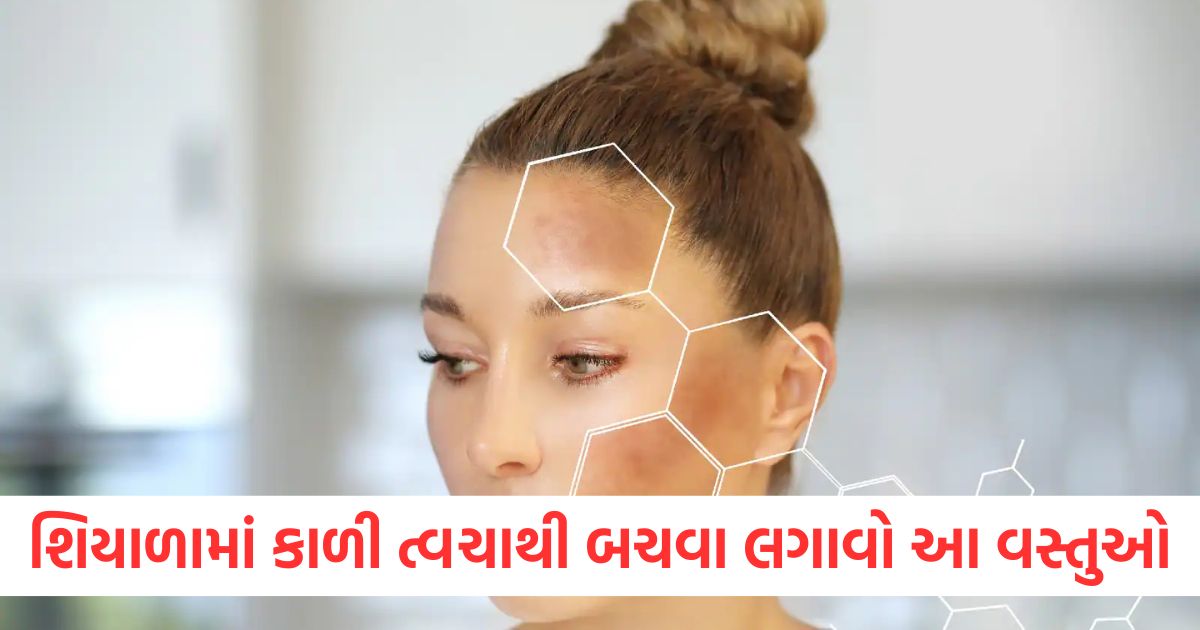 complexion of the face has been lost in winter then apply these 3 things on the face