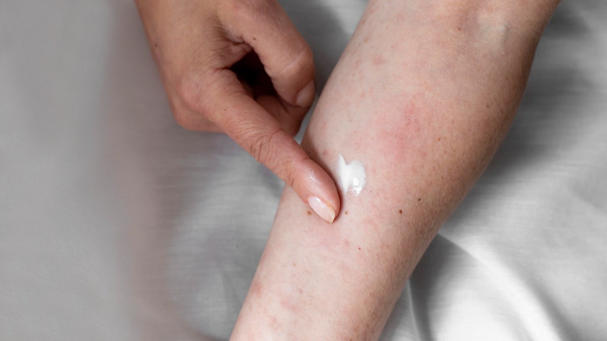 what is patch test in gujarati skin par patch test kaise karein2