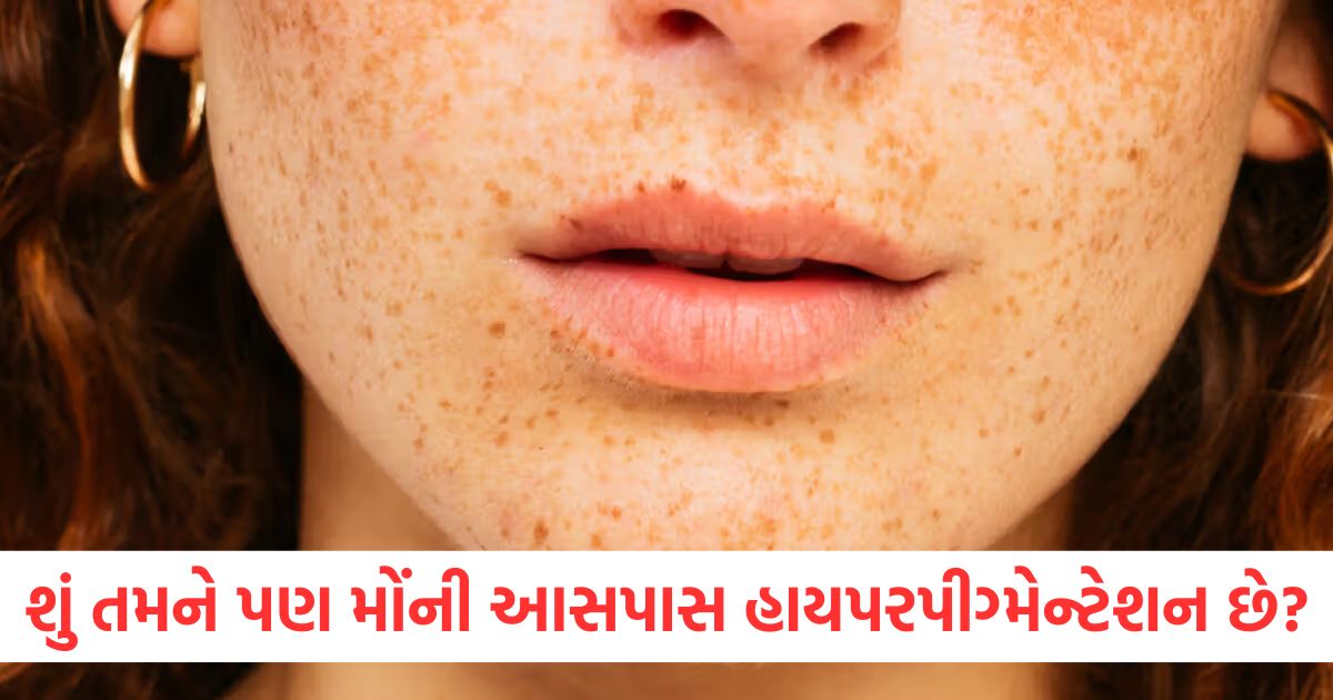 follow this easy home remedy to remove tanning and blackness around the lips2