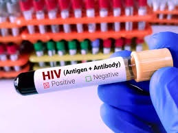 gujarat cm inaugurate asicon 2025 urgent and accelerated delivery of hiv services is critical to end aids by 2030