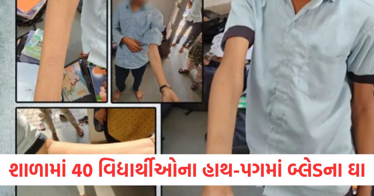 40 students in amreli school got blade wounds on their hands and feet2