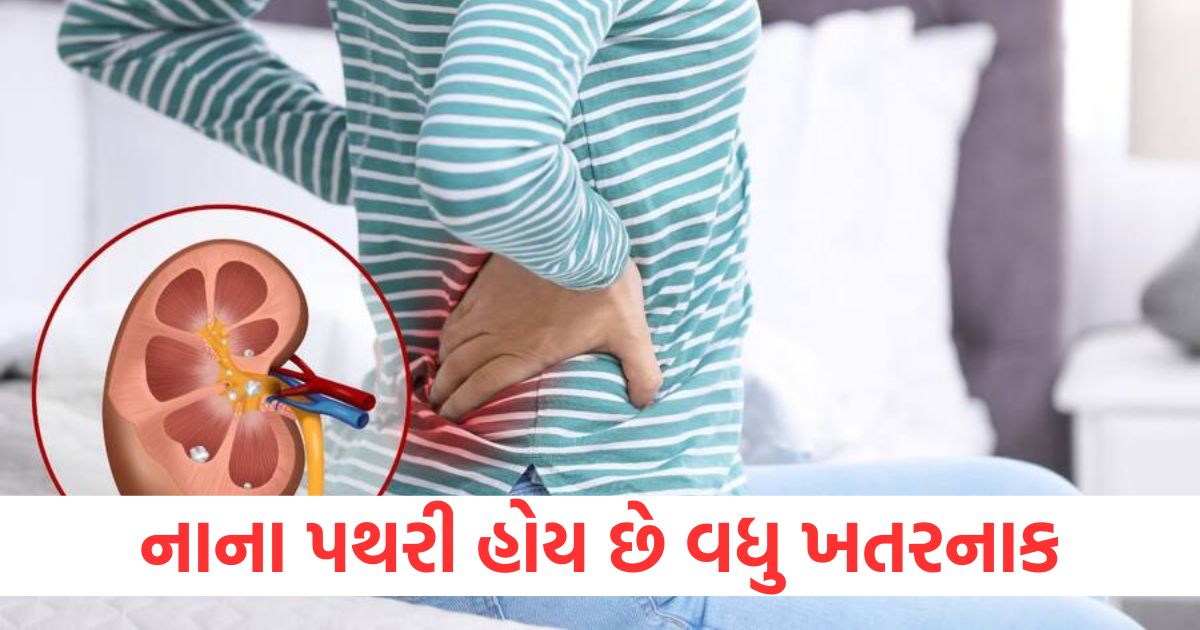 stones causes gallbladder kidney causes why small one dangerous reason doctor advice tips2