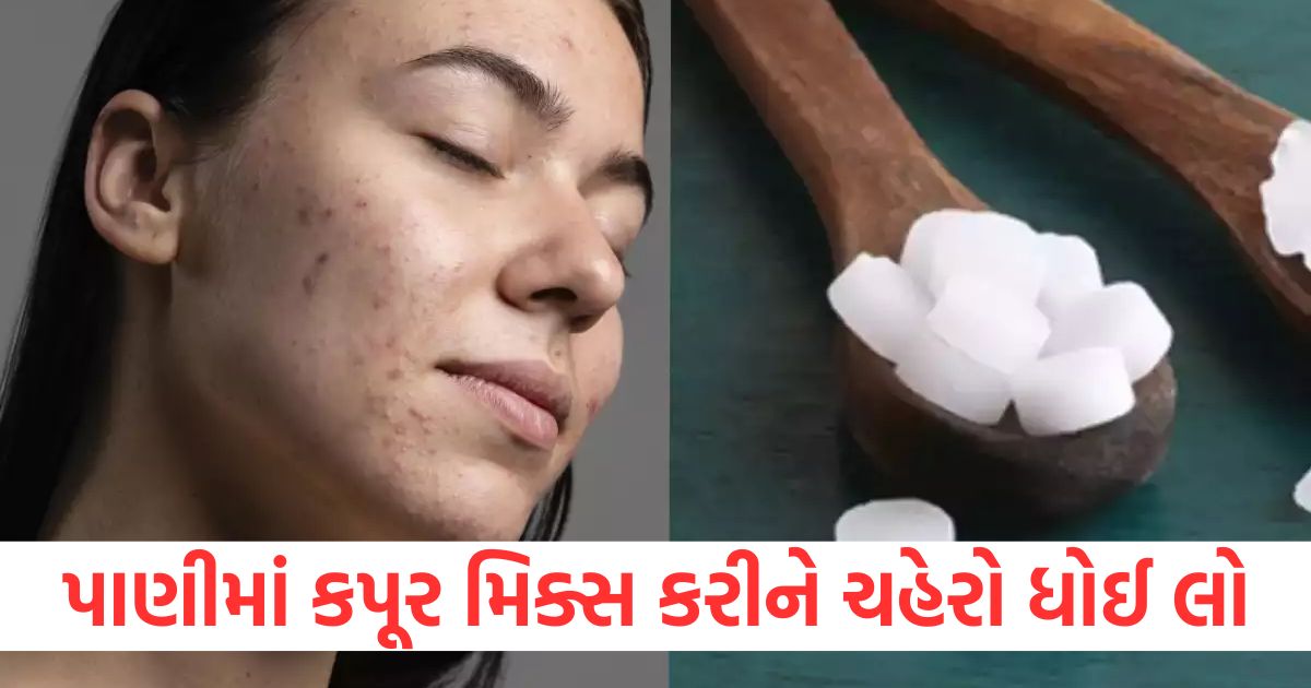 ways to use camphor for healthy skin2