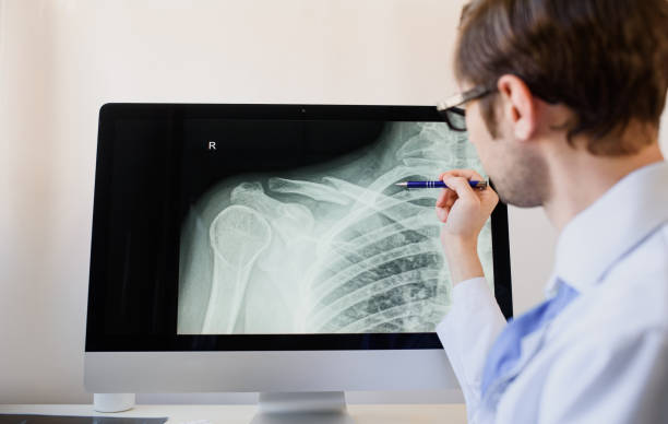 why do human bones become visible after getting cancer read full article1
