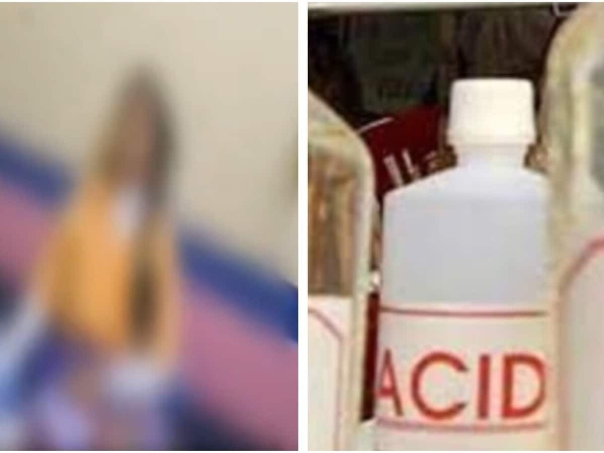 acid attack on bjp leader daughter on ram navami in begusarai bihar