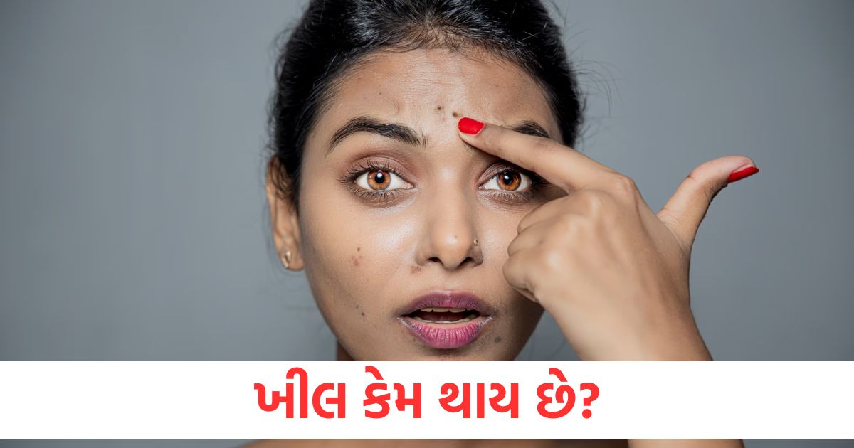 how to remove pimple spot from face reason precaution treatment