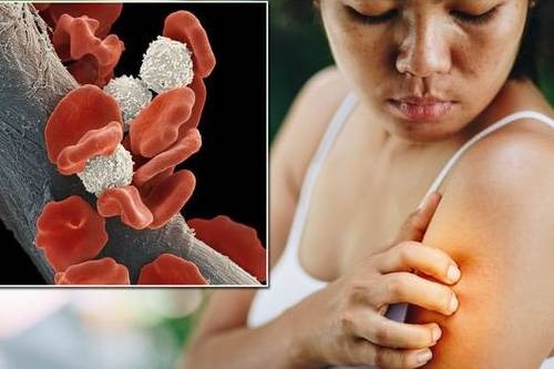 initial symptoms of blood cancer