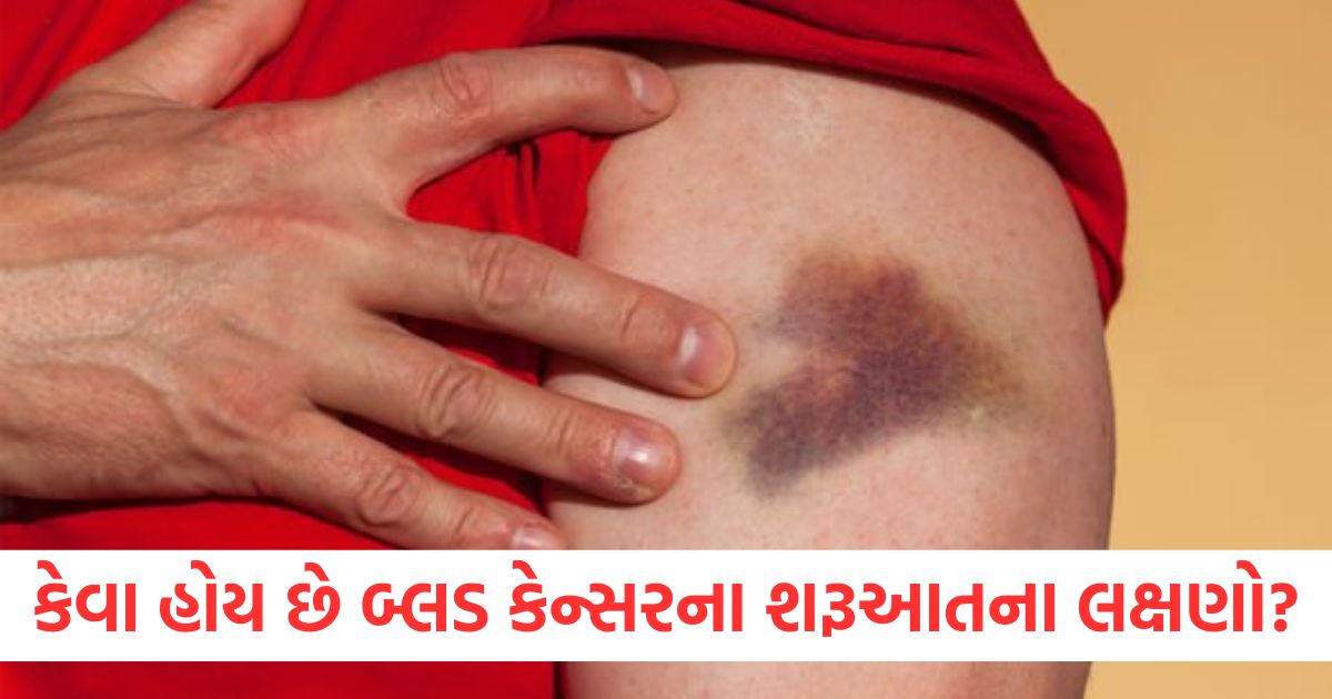 initial symptoms of blood cancer2