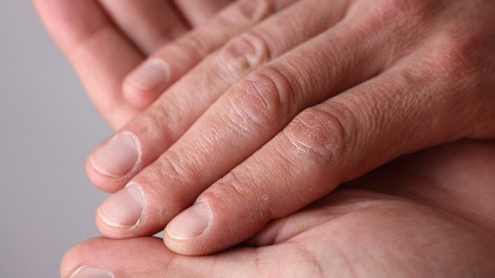 nails textures tells many things about your health1