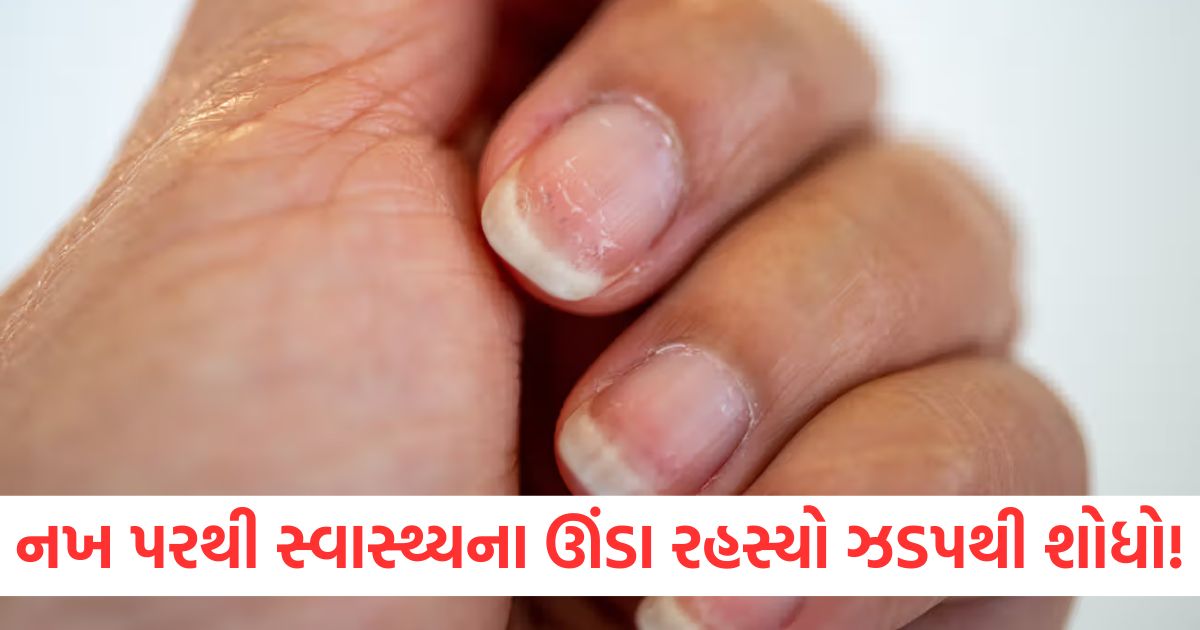 nails textures tells many things about your health2