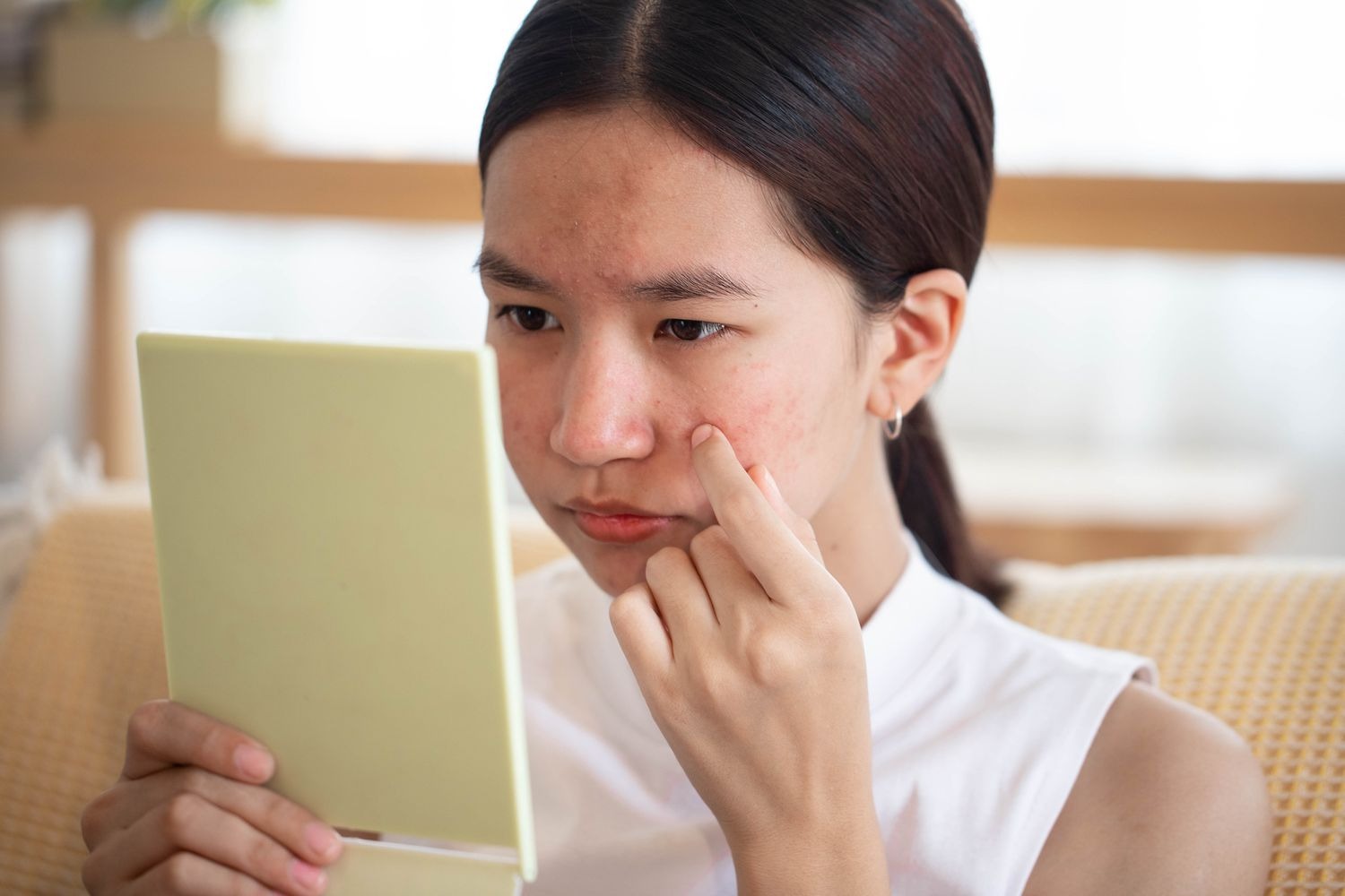 pimple cure tips use these things on a daily basis to get rid of pimples and acne1