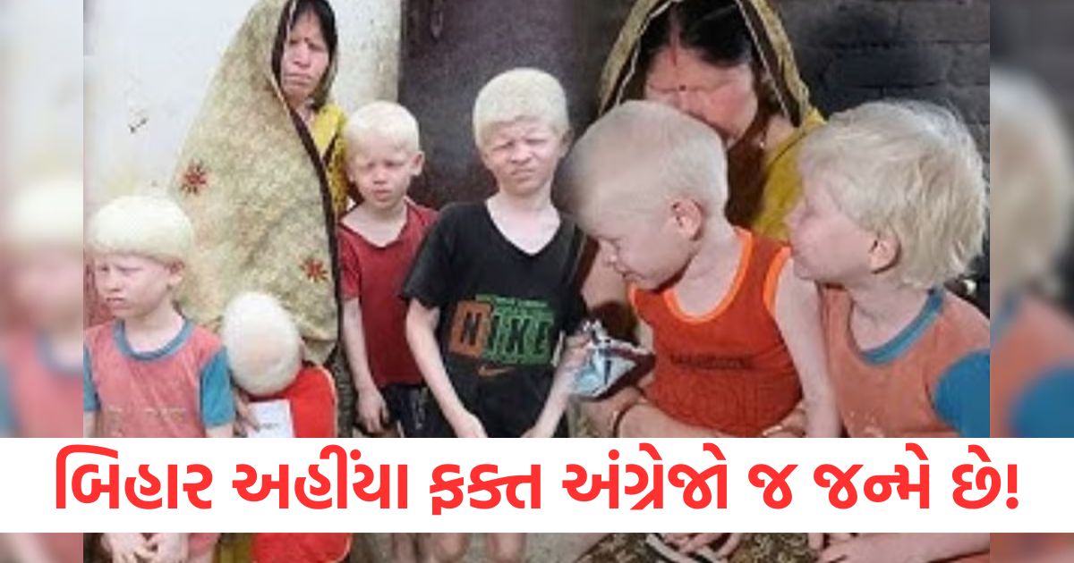 bihar gopalganj family suffers from genetic disease albinism people call britishers