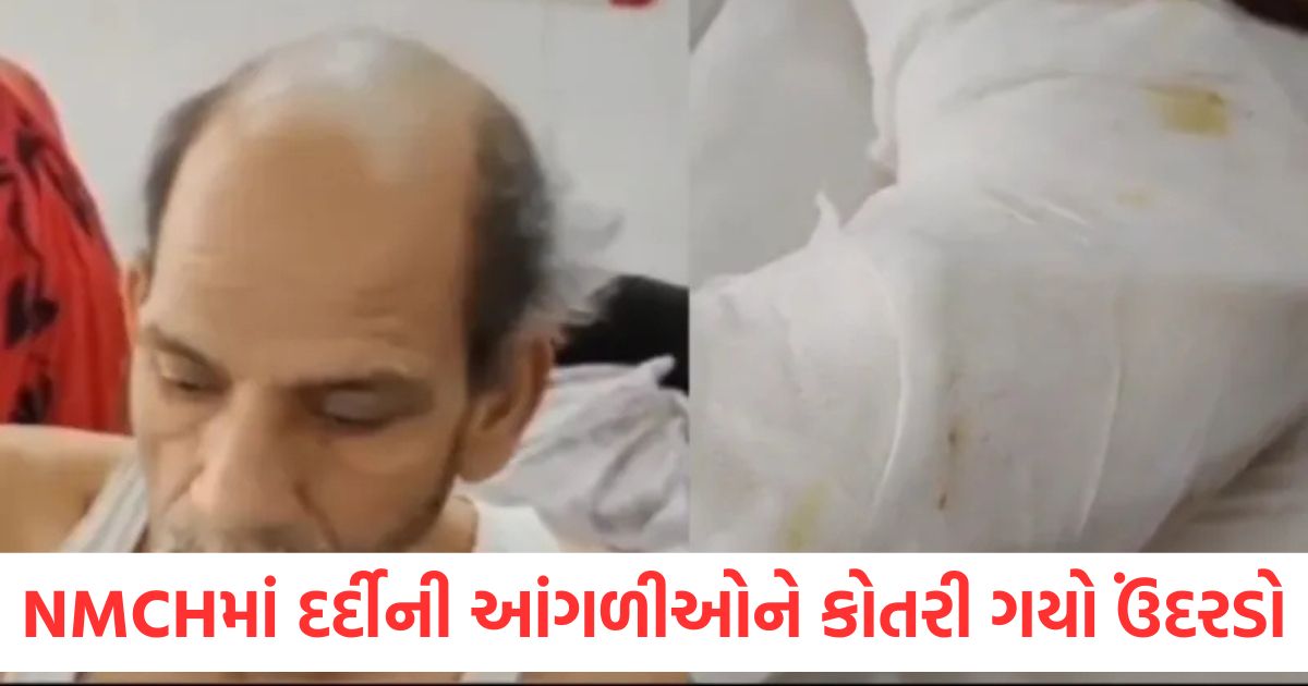 rat cuts patient leg fingers in nmch tejashwi yadav targeted mangal pandey and cm nitish kumar
