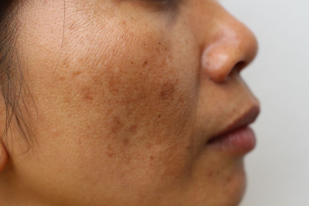 top 3 home remedies will make dull skin healthy and glowing the difference will start to show in just a few weeks