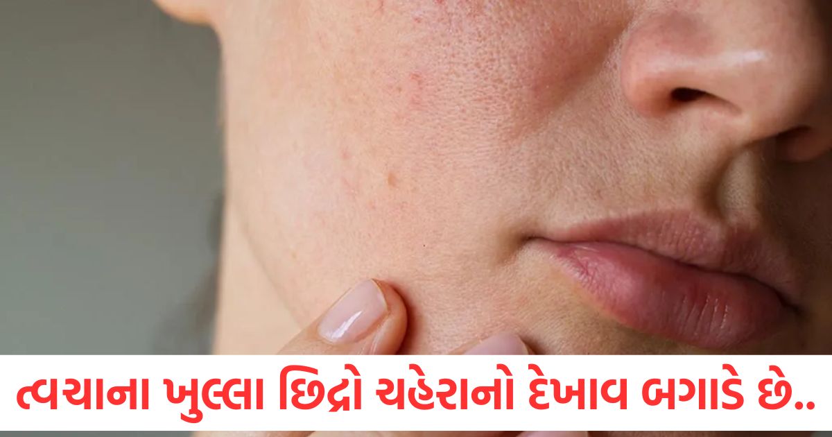 fashion beauty how to tighten pores home remedies to tighten pores for pimple free face