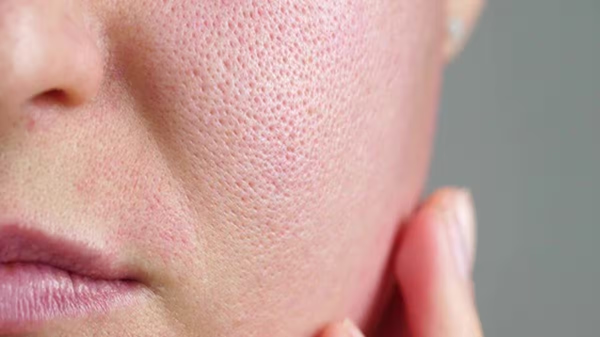 fashion beauty how to tighten pores home remedies to tighten pores for pimple free face11